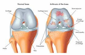 Bone, Joint & Cartilage Supplements