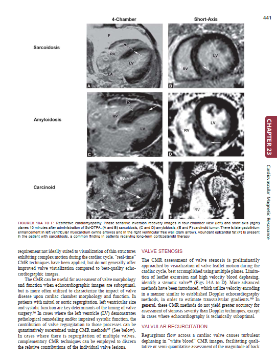 2025-01-31 15_36_05-Cardiology_An_Illustrated_Textbook.pdf - Foxit PDF Editor
