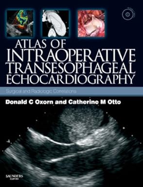 Atlas of Intraoperative Transesophageal Echocardiography (by Donald Oxorn) Atlas of Intraoperative Transesophageal Echocardiography (by Donald Oxorn)