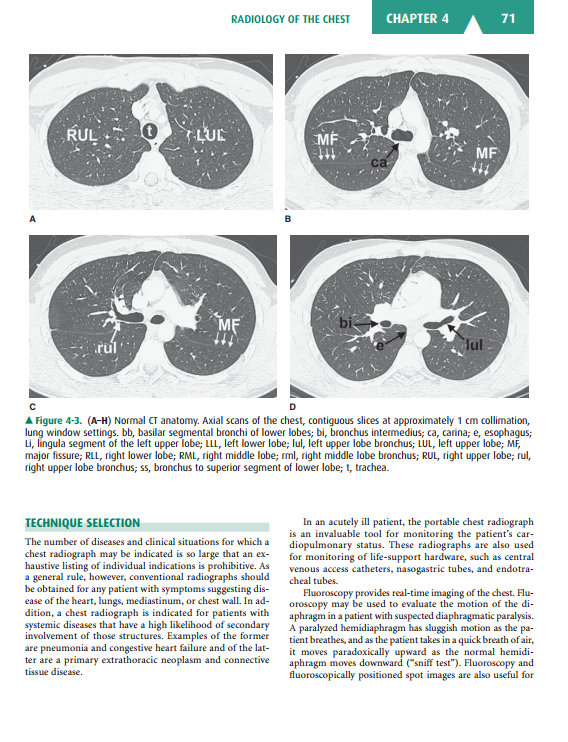 2025-05-08 10_12_22-Basic-Radiology.pdf - Foxit PDF Editor