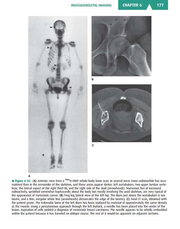 2025-05-08 10_12_35-Basic-Radiology.pdf - Foxit PDF Editor