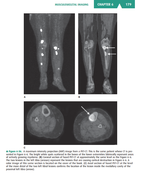 2025-05-08 10_12_45-Basic-Radiology.pdf - Foxit PDF Editor