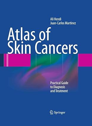 Atlas of Skin Cancers Practical Guide to Diagnosis and Treatment