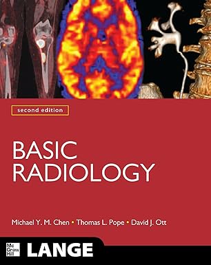 Basic Radiology 2nt Edition (by Michael Y.M. Chen) Basic Radiology 2nt Edition (by Michael Y.M. Chen)