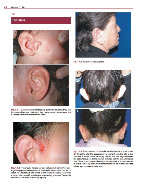 2025-06-09 08_09_38-Diagnosis-in-Otorhinolaryngology.pdf - Foxit PDF Editor