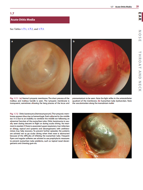 2025-06-09 08_10_00-Diagnosis-in-Otorhinolaryngology.pdf - Foxit PDF Editor