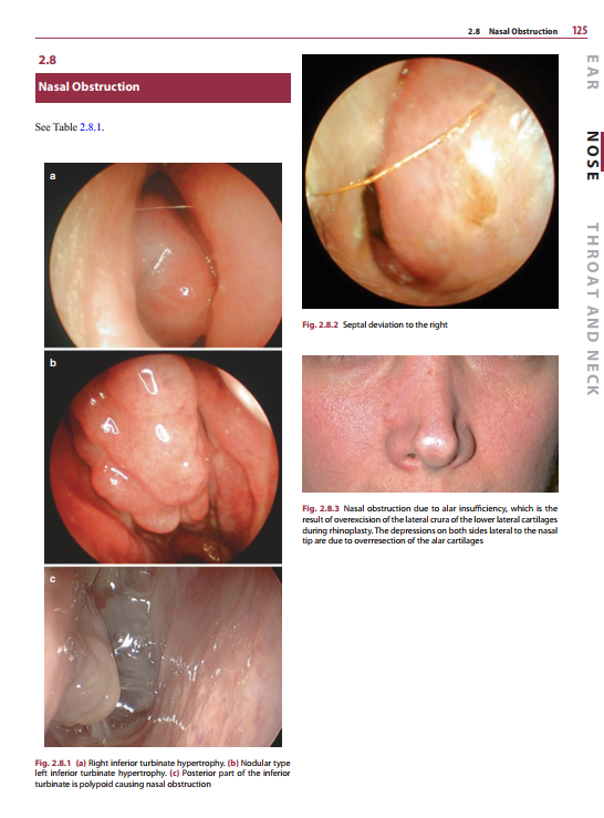 2025-06-09 08_10_50-Diagnosis-in-Otorhinolaryngology.pdf - Foxit PDF Editor