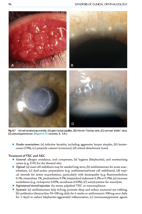 2025-06-25 11_52_06-Kanskis-Synopsis-of-Clinical-Ophthalmology.pdf - Foxit PDF Editor