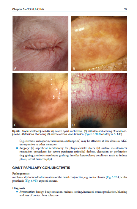 2025-06-25 11_52_17-Kanskis-Synopsis-of-Clinical-Ophthalmology.pdf - Foxit PDF Editor