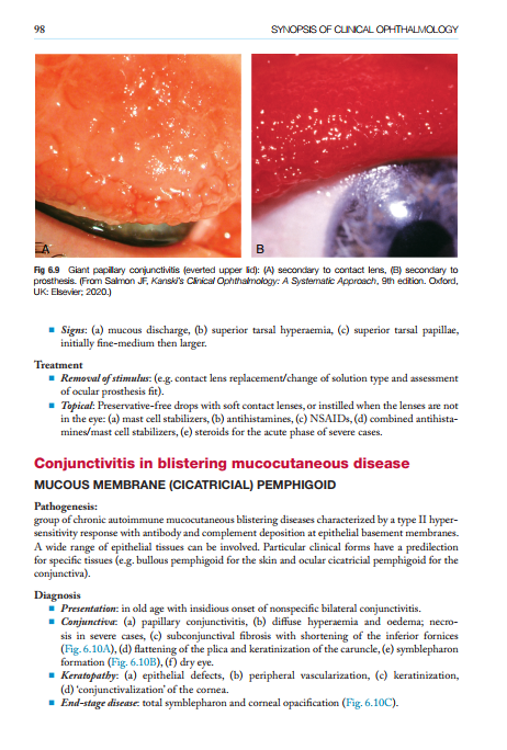2025-06-25 11_52_30-Kanskis-Synopsis-of-Clinical-Ophthalmology.pdf - Foxit PDF Editor