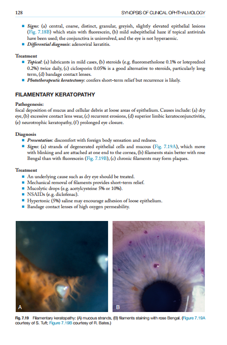 2025-06-25 11_52_46-Kanskis-Synopsis-of-Clinical-Ophthalmology.pdf - Foxit PDF Editor
