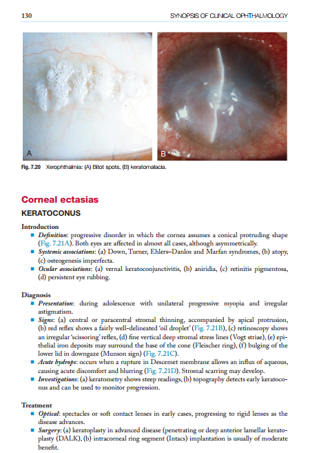 2025-06-25 11_52_59-Kanskis-Synopsis-of-Clinical-Ophthalmology.pdf - Foxit PDF Editor
