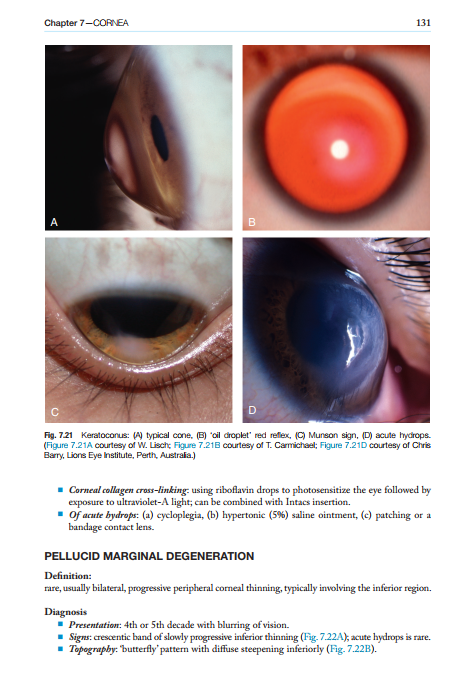 2025-06-25 11_53_12-Kanskis-Synopsis-of-Clinical-Ophthalmology.pdf - Foxit PDF Editor