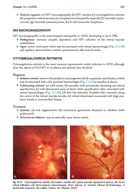 2025-06-25 11_53_27-Kanskis-Synopsis-of-Clinical-Ophthalmology.pdf - Foxit PDF Editor