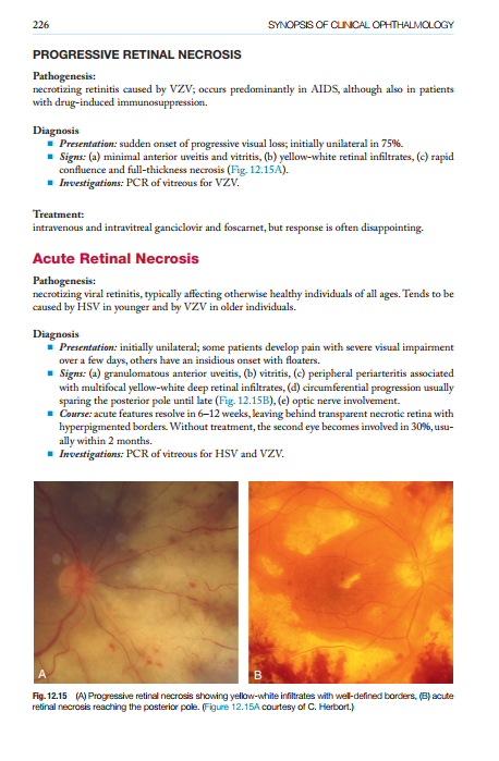 2025-06-25 11_53_40-Kanskis-Synopsis-of-Clinical-Ophthalmology.pdf - Foxit PDF Editor