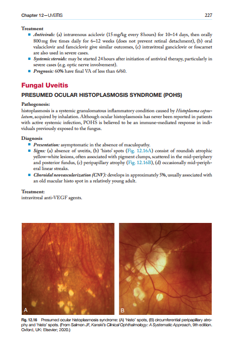 2025-06-25 11_53_52-Kanskis-Synopsis-of-Clinical-Ophthalmology.pdf - Foxit PDF Editor