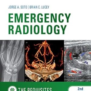 Emergency radiology the requisites (by Jorge A Soto)