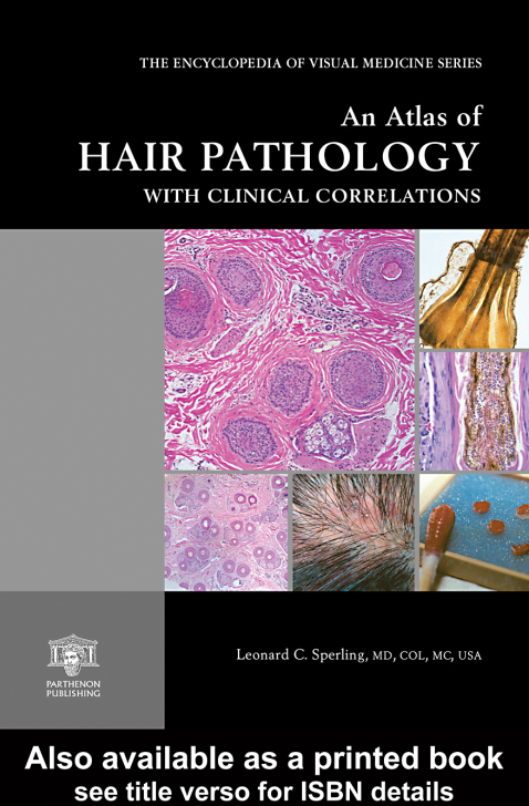 An Atlas of Hair Pathology with Clinical Correlations, 2nd Edition