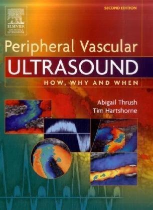 Peripheral Vascular Ultrasound (How, Why and When)