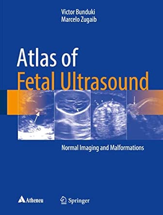 Atlas of Fetal Ultrasound: Normal Imaging and Malformations