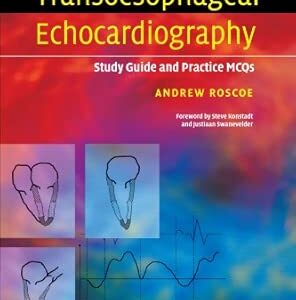 Transoesophageal Echocardiography Study Guide and Practice MCQs