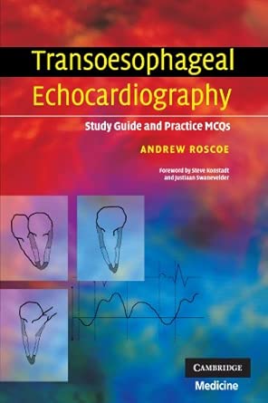 Transoesophageal Echocardiography Study Guide and Practice MCQs