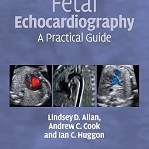 Fetal Echocardiography: A Practical Guide