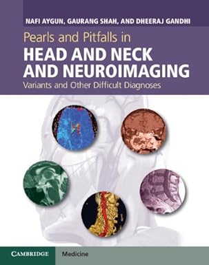 Pearls and Pitfalls in Head and Neck and Neuroimaging, 1st Edition