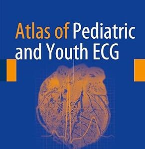 Atlas of Pediatric and Youth ECG