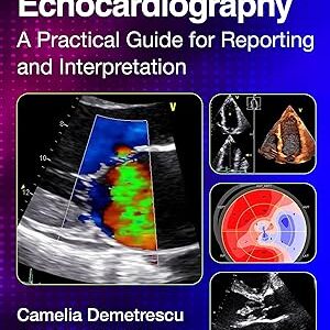 Echocardiography: A Practical Guide for Reporting and Interpretation