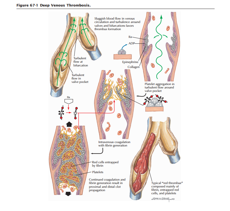 Clinical and Pathophysiological Comprehensive Analysis of Acquired Coagulation Inhibitors: A Diagnostic and Therapeutic Framework for Medical Practitioners