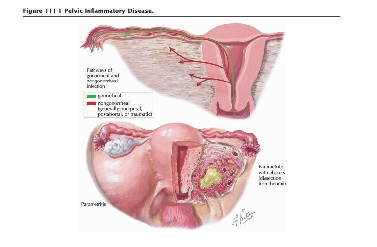 Differential Diagnosis of Abdominal Pain in Pregnant Women: A Clinical and Pathophysiological Analysis
