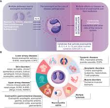 Comprehensive Clinical Analysis and Differential Diagnosis of Eosinophilia: A Global Medical Perspective