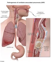 Assessment of Postoperative Fever: A Clinical and Pathophysiological Treatise for the Modern Practitioner