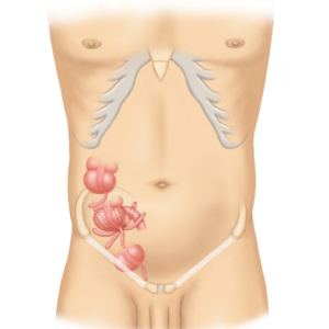 The Path of Healing: A Comprehensive Clinical Analysis of Acute Appendicitis