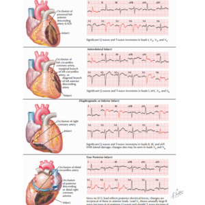 The Heart in the Sanctuary of Life: A Comprehensive Clinical and Pathophysiological Analysis of Acute Coronary Syndromes in Pregnancy